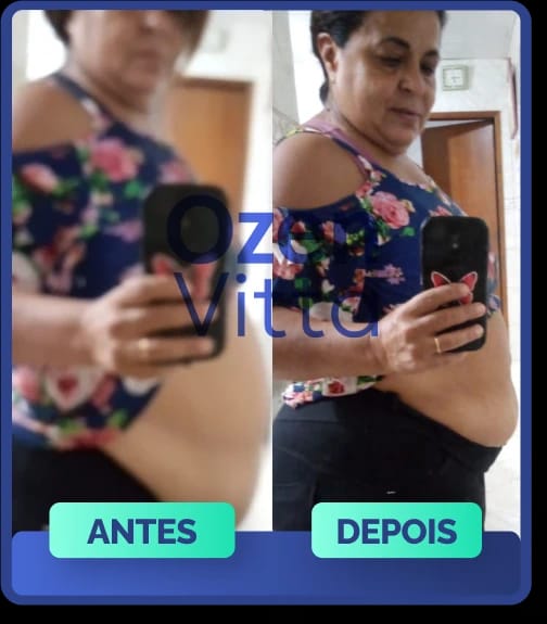 Antes e depois de cliente que usou Ozen Vitta - transformação 1