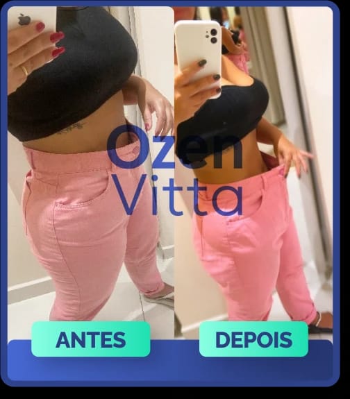 Antes e depois de cliente que usou Ozen Vitta - transformação 3