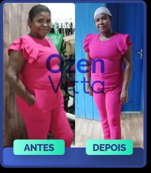 Antes e depois de cliente que usou Ozen Vitta - transformação 4