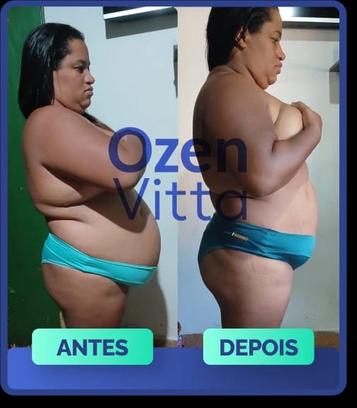Antes e depois de cliente que usou Ozen Vitta - transformação 5