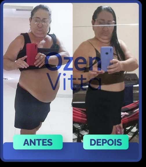 Antes e depois de cliente que usou Ozen Vitta - transformação 6